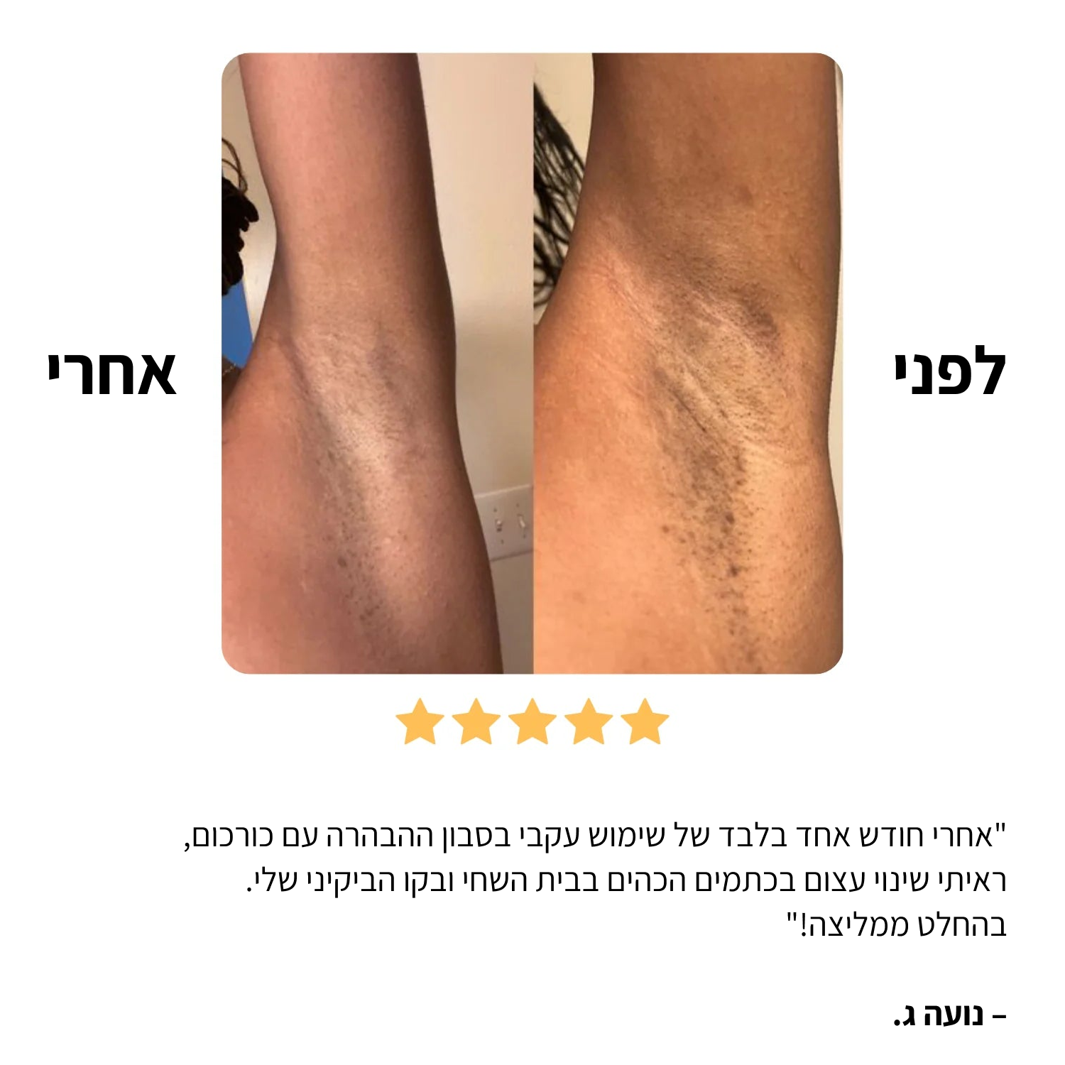 סבון סופרפוד לחיסול הכהויות בעור