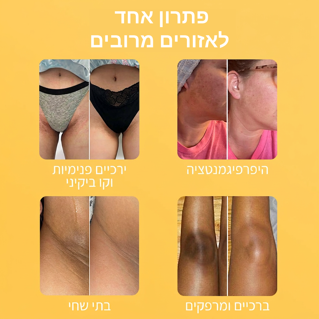 סבון סופרפוד לחיסול הכהויות בעור